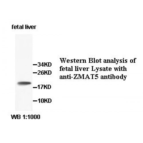 ZMAT5 Antibody