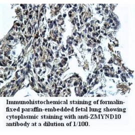 ZMYND10 Antibody