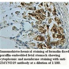 ZMYND19 Antibody