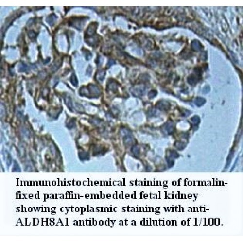 ALDH8A1 Antibody