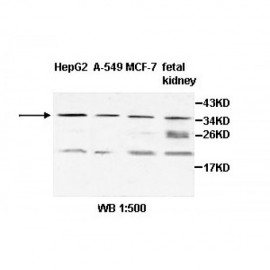 ZNF101 Antibody