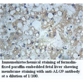 ALG9 Antibody
