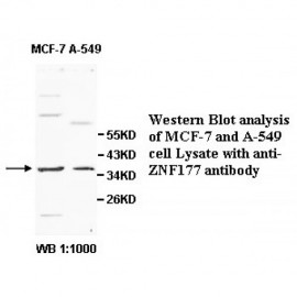 ZNF177 Antibody