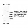 ZNF177 Antibody