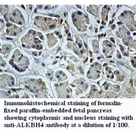 ALKBH4 Antibody