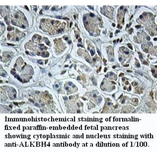 ALKBH4 Antibody