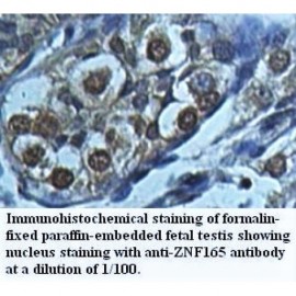 ZNF165 Antibody