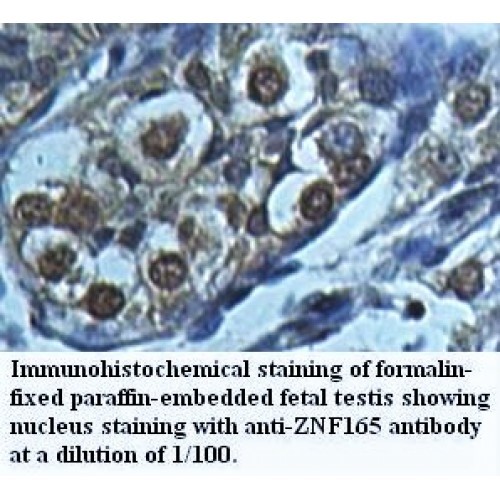 ZNF165 Antibody