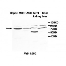 ZNF182 Antibody