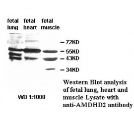 AMDHD2 Antibody