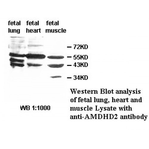 AMDHD2 Antibody