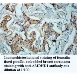 AMDHD1 Antibody