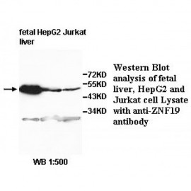 ZNF19 Antibody