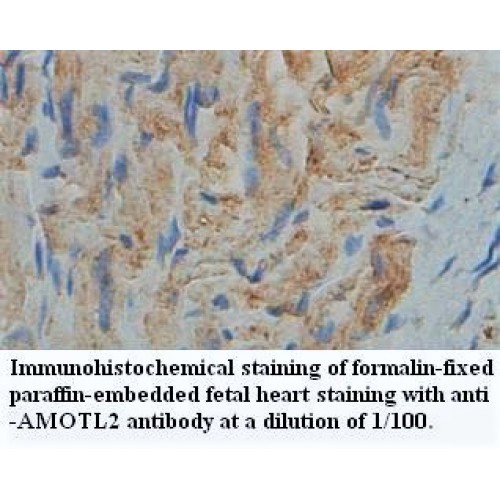 AMOTL2 Antibody