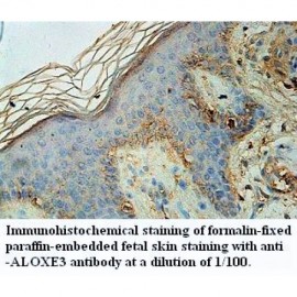 ALOXE3 Antibody