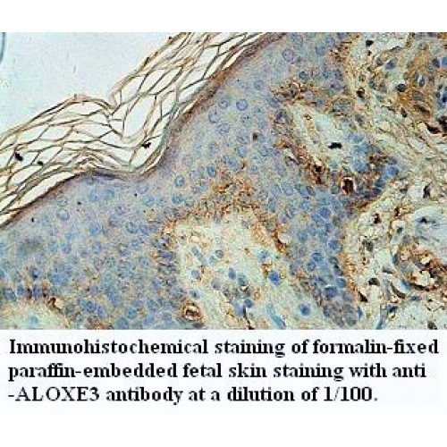 ALOXE3 Antibody