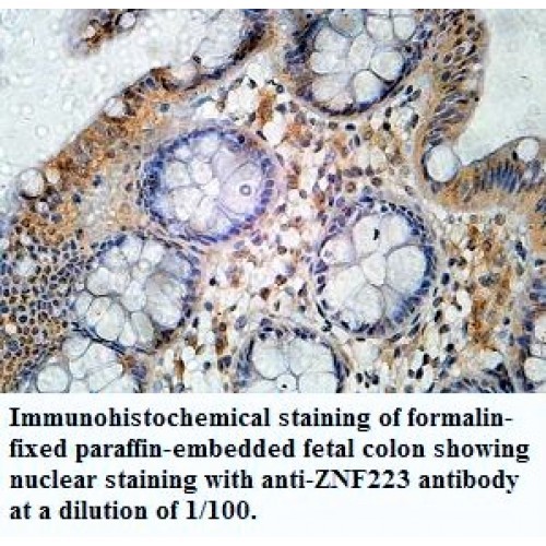 ZNF223 Antibody
