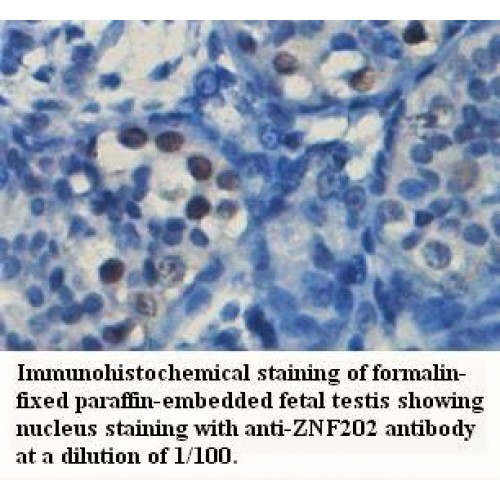 ZNF202 Antibody