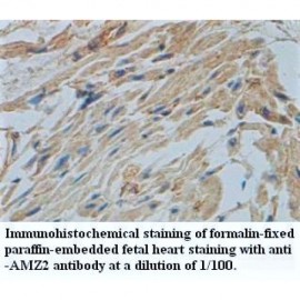 ZNF248 Antibody