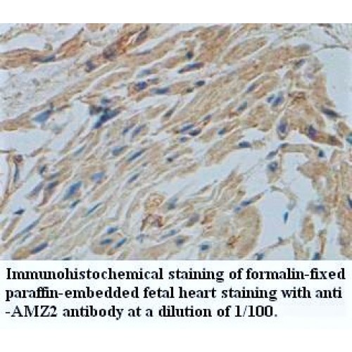 ZNF248 Antibody
