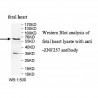 ZNF257 Antibody