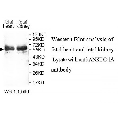 ANKDD1A Antibody