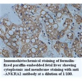 ANKRA2 Antibody