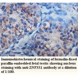 ZNF331 Antibody