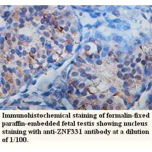 ZNF331 Antibody