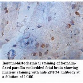 ZNF34 Antibody