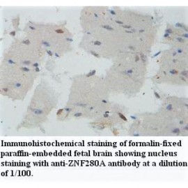 ZNF34 Antibody