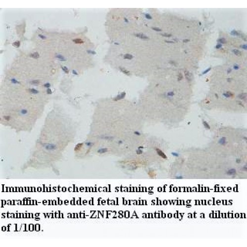 ZNF34 Antibody