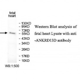 ANKRD13D Antibody