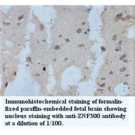 ZNF300 Antibody