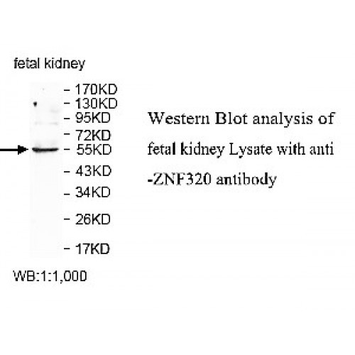 ZNF320 Antibody