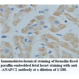 ANAPC2 Antibody