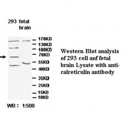 Calreticulin Antibody