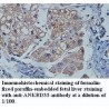 ANKRD33 Antibody