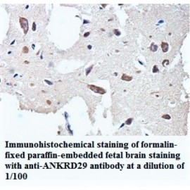 ANAPC2 Antibody