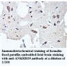 ANKRD29 Antibody