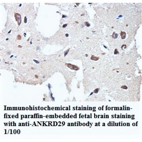 ANAPC2 Antibody