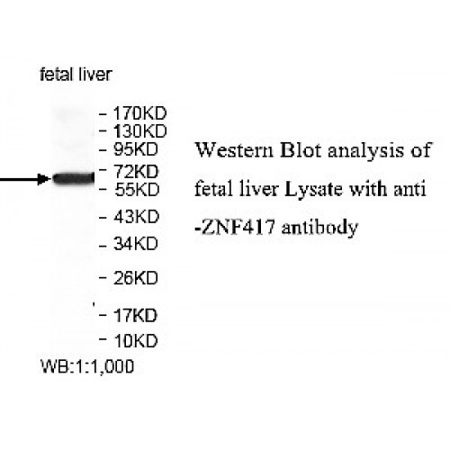 ZNF404 Antibody