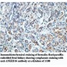 ANKRD16 Antibody