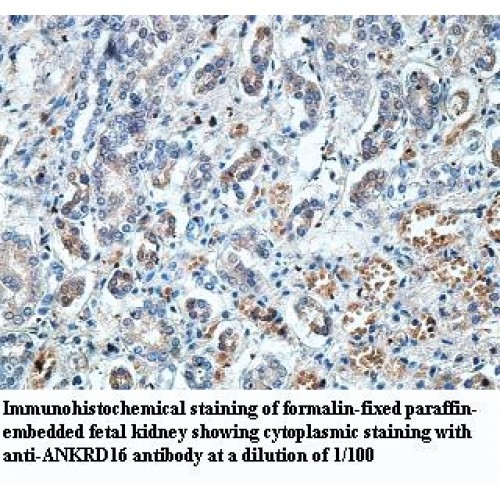 ANAPC2 Antibody