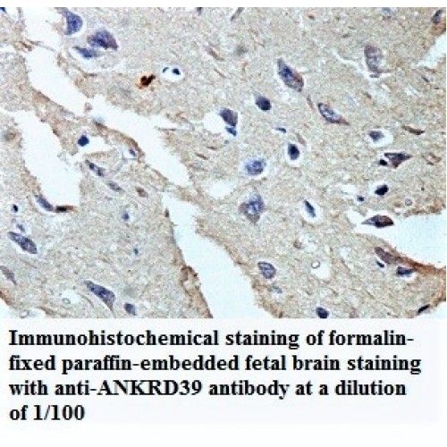 ANAPC2 Antibody
