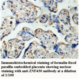 ANAPC2 Antibody