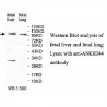 ANKRD44 Antibody