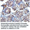 ANKRD45 Antibody