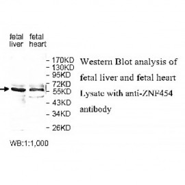 PIAS3 Antibody