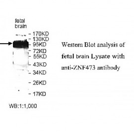 ZNF454 Antibody